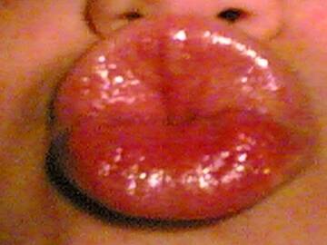 kiss