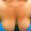 Public photo of xtremmature